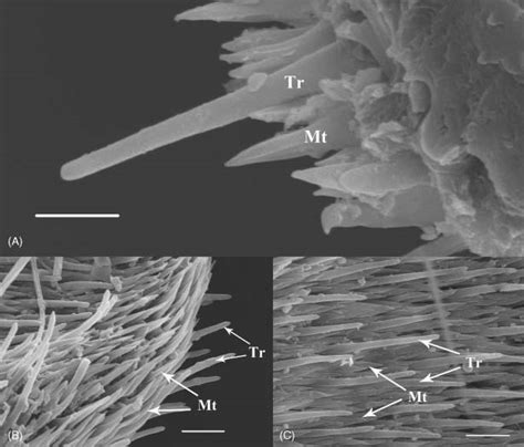 Scanning Electron Micrographs Of Trichoid Sensilla On The Antennal