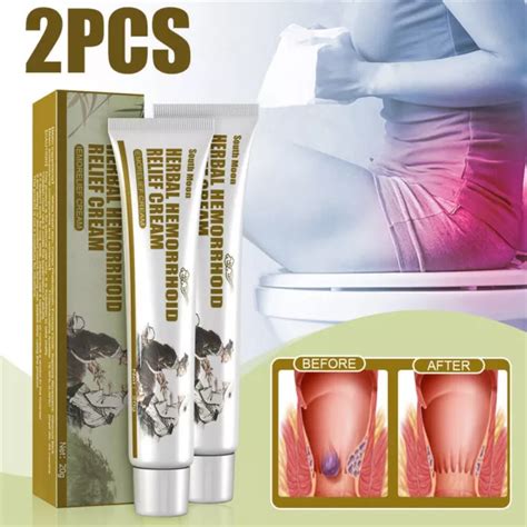 HAEMORRHOIDS CREAM HEMORRHOIDS Hemorrhoid Piles Anal Fissure Prolapse Gel G PicClick UK