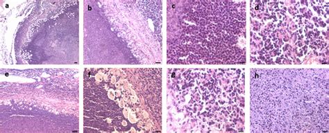 Histological Features Of Extra Testicular Growth The Central Region