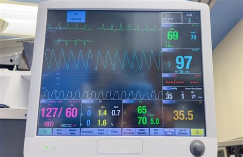 Moniteur D H Pital Un Symbole Des Signes Vitaux De Soins De Sant Et Du