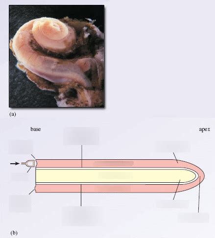 General HEENT Diagram Quizlet