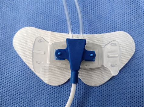 Medical Supplies Statlock Catheter Securement Device - China Picc ...