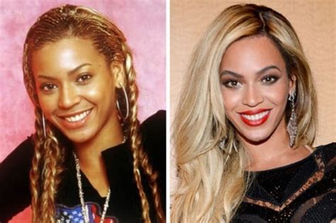 Celebrities Who Bleached Their Skin