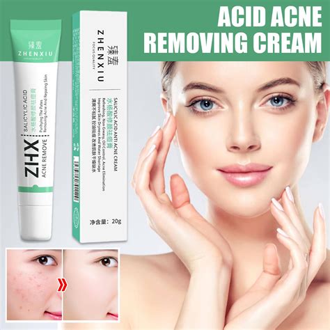 Acne Removal Cream Acne Treatment Fade Acne Spots Oil Control Shrink ...