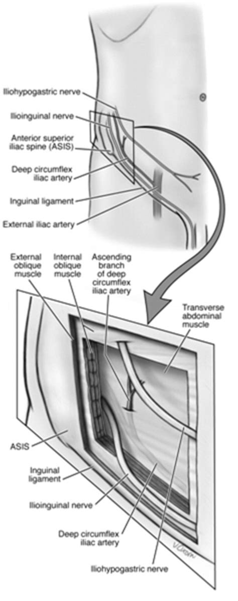 Ilioinguinal Nerve Block Anatomy