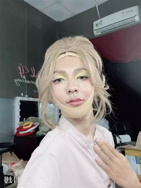 Hot Tiktoker V Th Nh Ti T L Dao K O Di N M O Sau Ph U Thu T G Y B T Ng