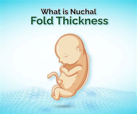 Nuchal Fold Thickness Expert Recommendations For Prenatal Care In