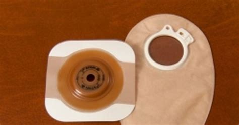 Types Of Ileostomy Procedures And Possible Risks Facty Health