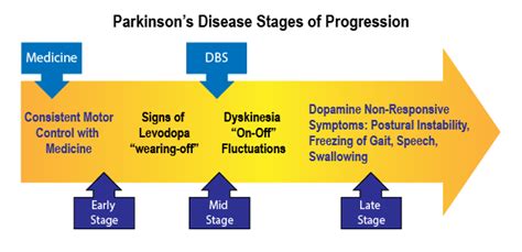 Disease Progression Nw Parkinson S Foundation