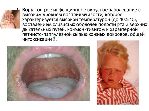 Основные инфекционные болезни, их классификация и профилактика. Тема 1. ...