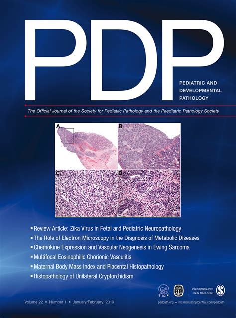 Ovotesticular Disorder Of Sex Development Ovotestis In SimpsonGolabi