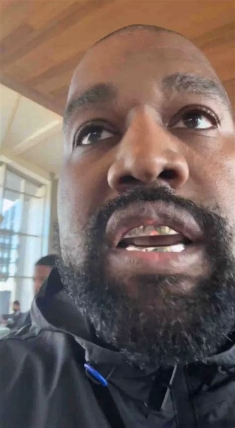 Kanye West Fans Concerned As He Shows Lump On Lip After Getting £