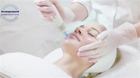 Stem Cells Exosome Microneedling Belgravia Lamure Aesthetic Clinic