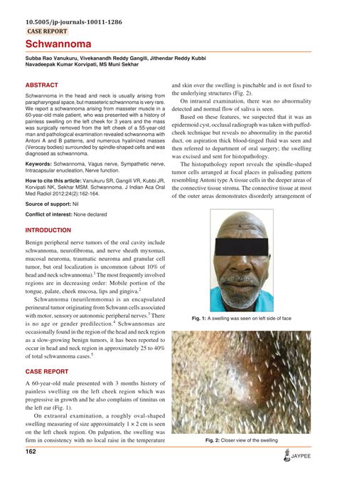Pdf Schwannoma