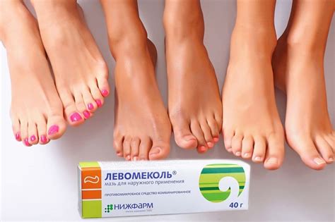 Как лечить мокрые мозоли на пальцах ног: мази, пластыри и народные средства