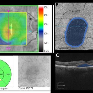 Visualization Of Methods In Optical Coherence Tomography Oct And