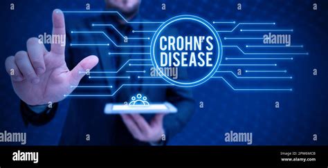 Rédaction affichant le texte Crohn S est maladie mot écrit sur la