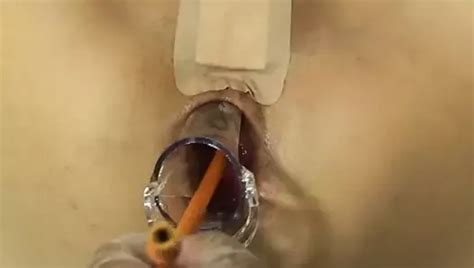 Elmer S Wife Anal Fisting Speculum 5 Japanese Porn XHamster