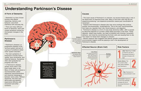 New treatments will change how Parkinson's can you die is viewed 38