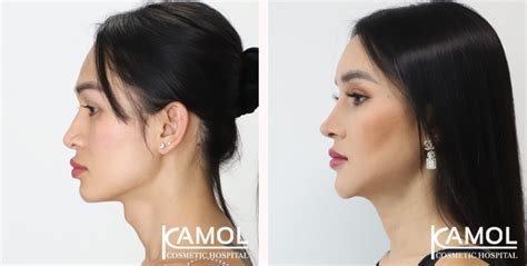 Kamol Cosmetic Hospital