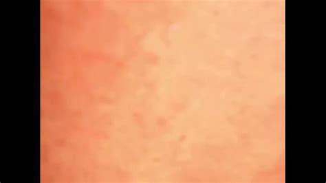 Naked In The Bushes By Road Pornhub Gay