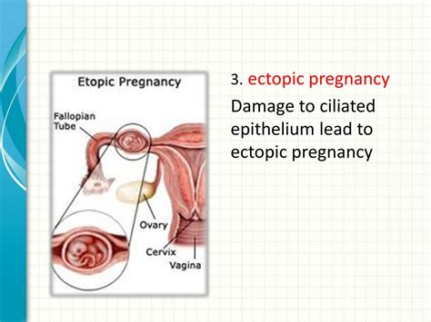 Ppt Pelvic Inflammatory Disease Powerpoint Presentation Free Download Id 2140367