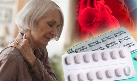 Statins side effects: Cholesterol busting drugs could present these