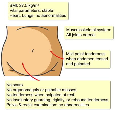 Spigelian Hernia - Interactive case study | Clinical Odyssey by Medical Joyworks, LLC