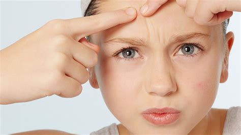 如何解决“青春痘”？_陆远熙_知道日报_百度知道