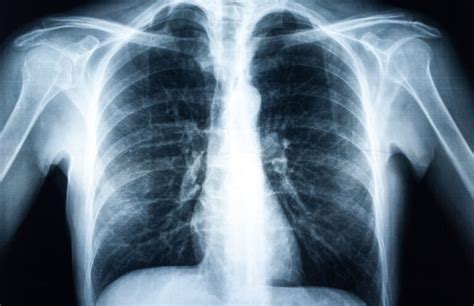 Vulva de la mujer sana síntomas que te dicen que tu vagina no está saludable