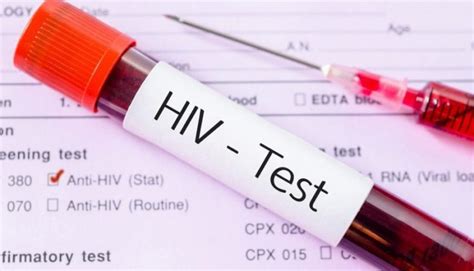 ВІЛ: визначення, причина, симптоми, діагностика та передача