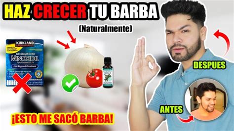 Como Hacer Crecer La Barba Naturalmente HACERCOSAS