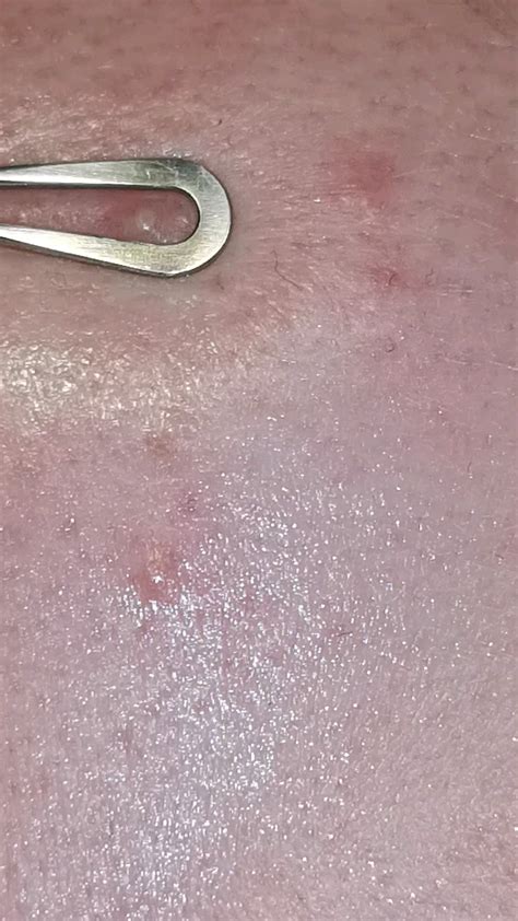 lil pop   greasy forehead rpopping