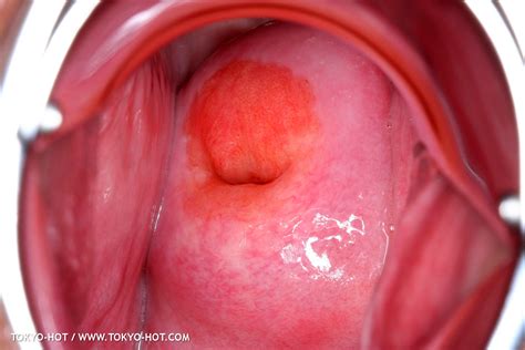 Tokyo Hot N0886 Set2 Momoko Oishi 694 Porn Pic