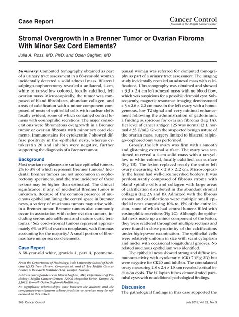 Stromal Overgrowth In A Brenner Tumor Or Ovarian Fibroma With Minor Sex Cord Elements Request PDF