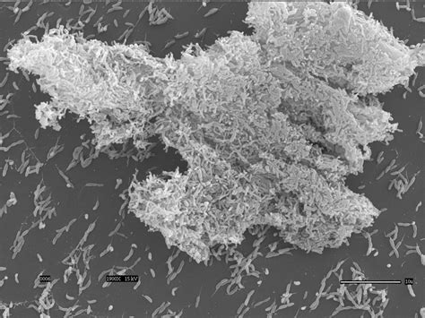 Mature Biofilm Of Caulobacter Attached To Glass Coverslip Viewed With