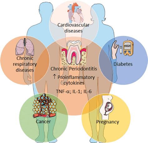 What Is Severe Systemic Disease