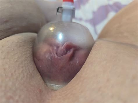 Tight Teen Using Pussy Pump 8 Nude Pics XHamster