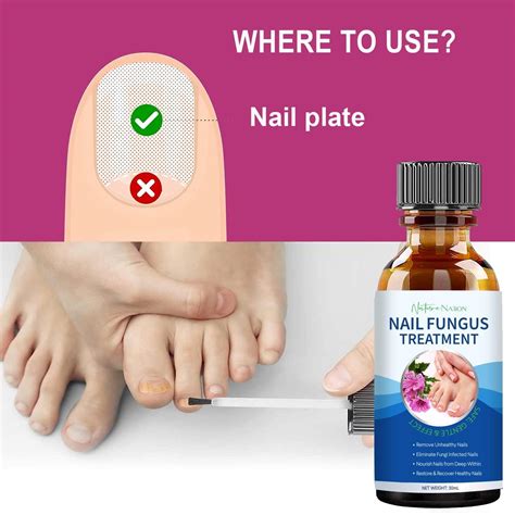 how to know if toenail fungus is dying 10
