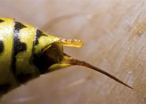 Bee Stings And Wasp Stings What You Need To Know Bens Bees