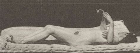 Nude Woman Lying Down And Having Artificially Induced Convulsions Rbm Qp M C