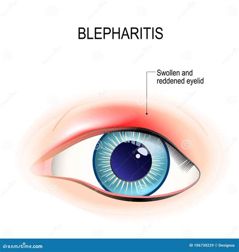 Lower Eyelid Anatomy Anatomy Drawing Diagram