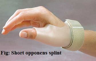 Short opponens splint