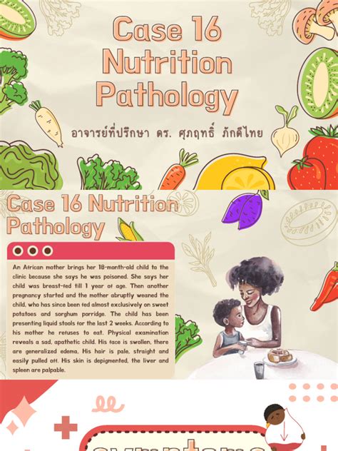 Symptoms of Kwashiorkor | Download Free PDF | Edema | Medicine