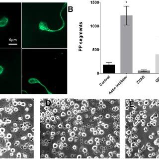 Actin Polymerization Inhibitor Latrunculin Treatment Does Not Affect