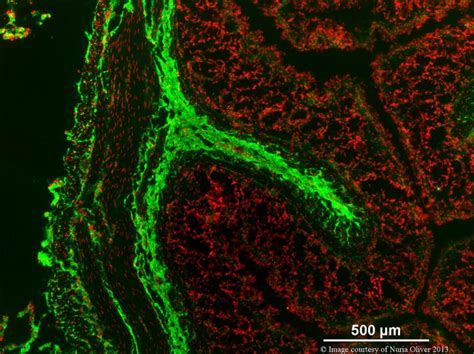 Biomaterials – Edelman Lab