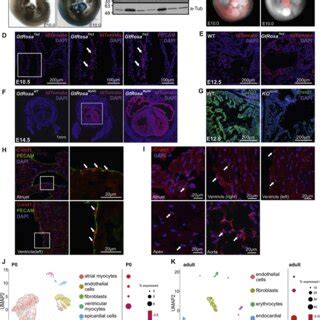 Molecular And Cellular Cardiac Phenotype Of E13 5 KO MyHC Mice A Anp