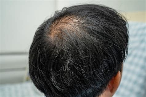 No hair Images - Search Images on Everypixel