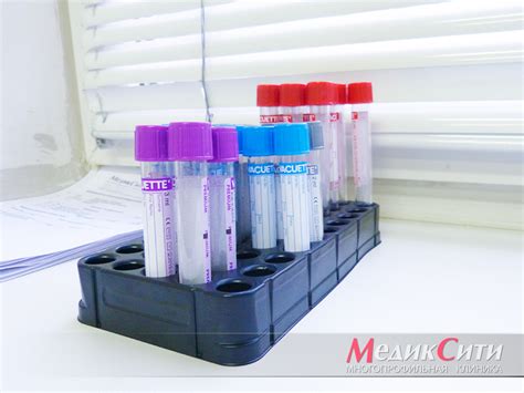 Кардиомиопатия (КМП). Классификация кардиомиопатий. Диагностика и лечение