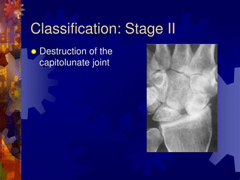 Ppt Slac Wrist Powerpoint Presentation Free Download Id1099204